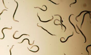 Parasiten, die im menschlichen Körper leben