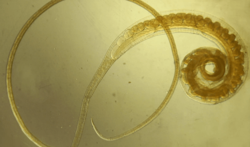 Trichocephalose von Vlasov