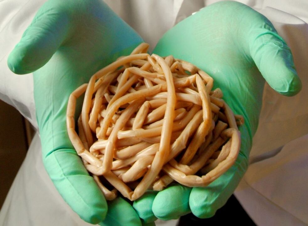 Was Parasiten haben, haben Menschen